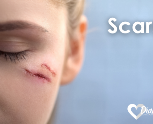 scars, a woman's face with a visible healing cut