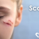 scars, a woman's face with a visible healing cut