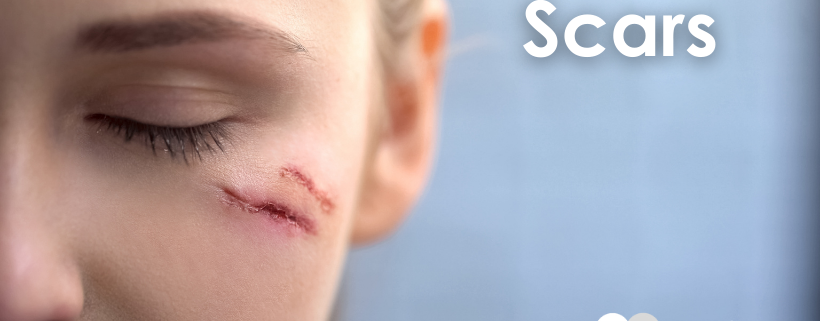 scars, a woman's face with a visible healing cut