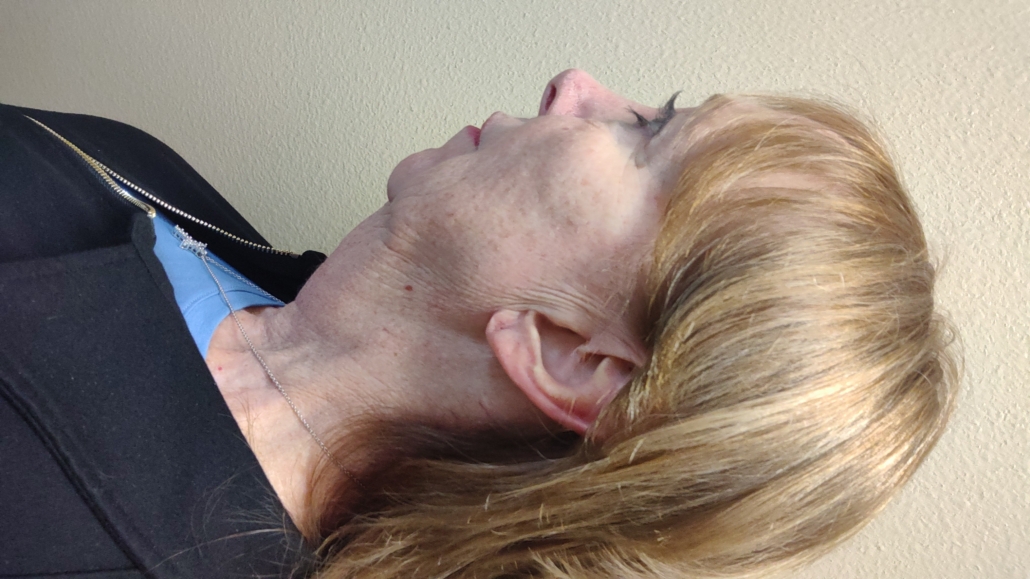 Diana Journy Profile Before Facelift